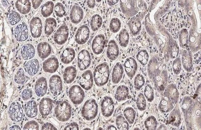 Cyclin D1 Antibody in Immunohistochemistry (Paraffin) (IHC (P))