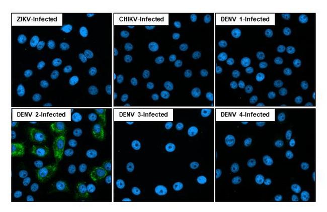 Dengue Virus Type 2/4 NS2B (Thailand/16681/1984) Antibody in Immunocytochemistry (ICC/IF)