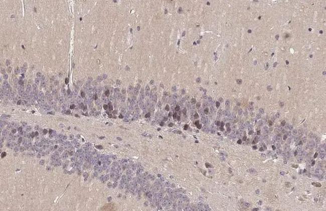 DRD1 Antibody in Immunohistochemistry (Paraffin) (IHC (P))