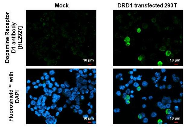 DRD1 Antibody in Immunocytochemistry (ICC/IF)
