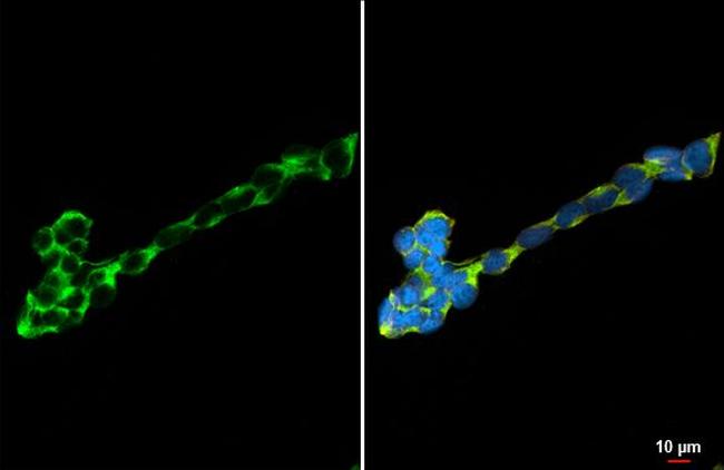 DRD5 Antibody in Immunocytochemistry (ICC/IF)
