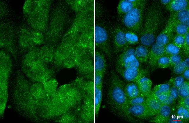 DUSP8 Antibody in Immunocytochemistry (ICC/IF)
