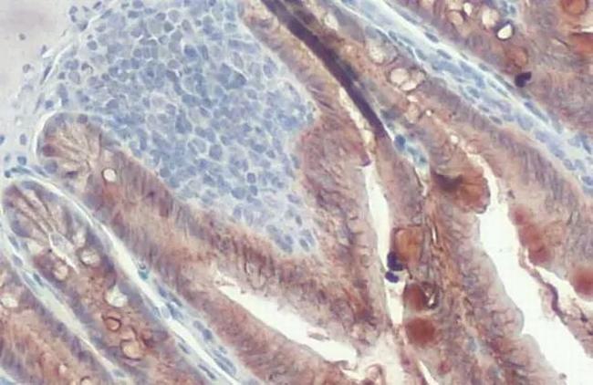 E-cadherin Antibody in Immunohistochemistry (Paraffin) (IHC (P))