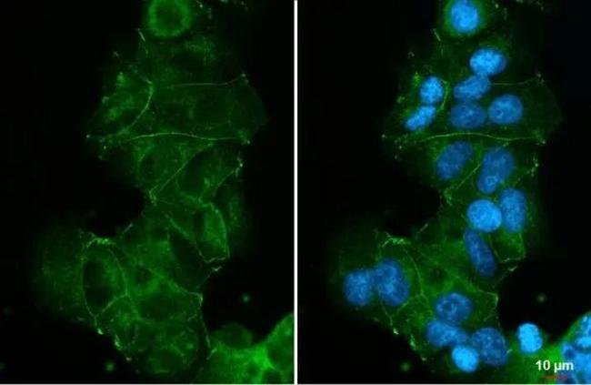 E-cadherin Antibody in Immunocytochemistry (ICC/IF)
