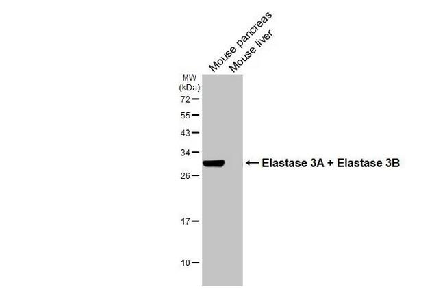 Elastase 3A/3B Antibody in Western Blot (WB)