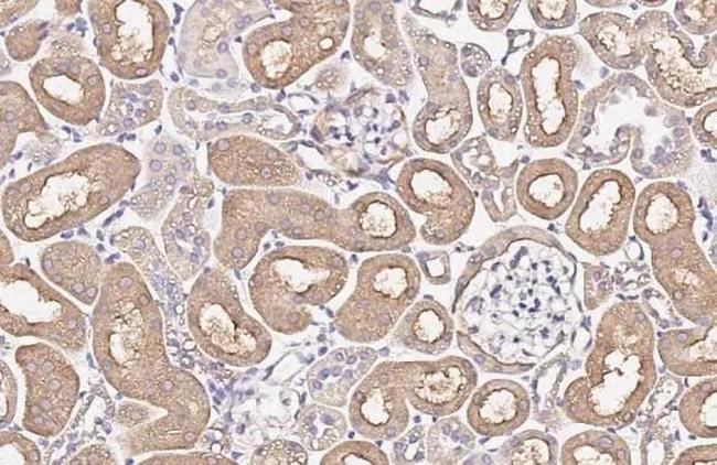 alpha-ENaC Antibody in Immunohistochemistry (Paraffin) (IHC (P))