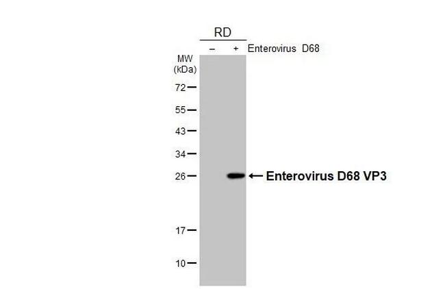 Enterovirus D68 VP3 (Strain: 37-99) Antibody in Western Blot (WB)