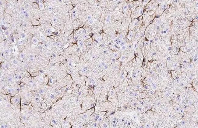 EphA3 Antibody in Immunohistochemistry (Paraffin) (IHC (P))