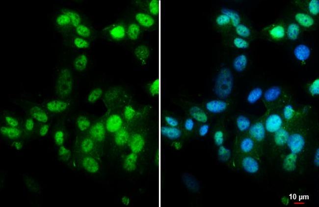 Estrogen Receptor alpha Antibody in Immunocytochemistry (ICC/IF)