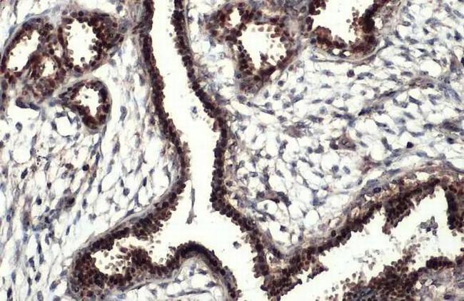 Estrogen Receptor alpha Antibody in Immunohistochemistry (Paraffin) (IHC (P))