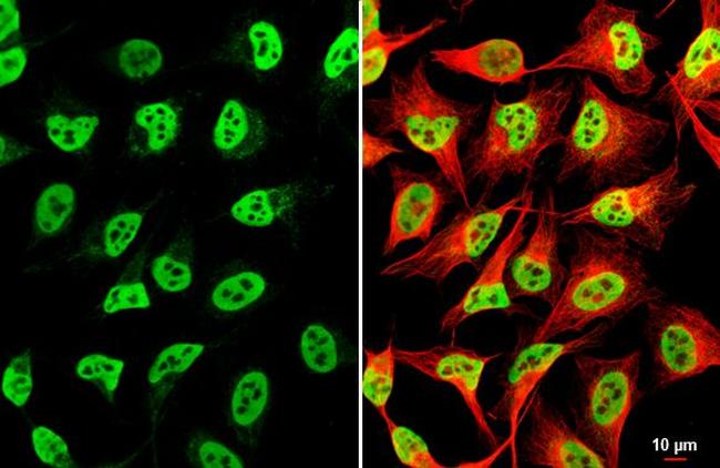 EWSR1 Antibody in Immunocytochemistry (ICC/IF)
