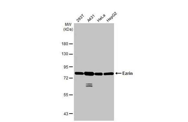 Ezrin Antibody in Western Blot (WB)