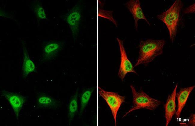 BRIP1 Antibody in Immunocytochemistry (ICC/IF)