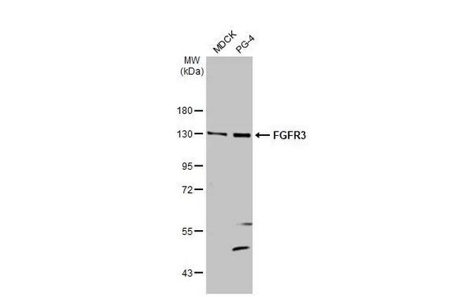 FGFR3 Antibody in Western Blot (WB)