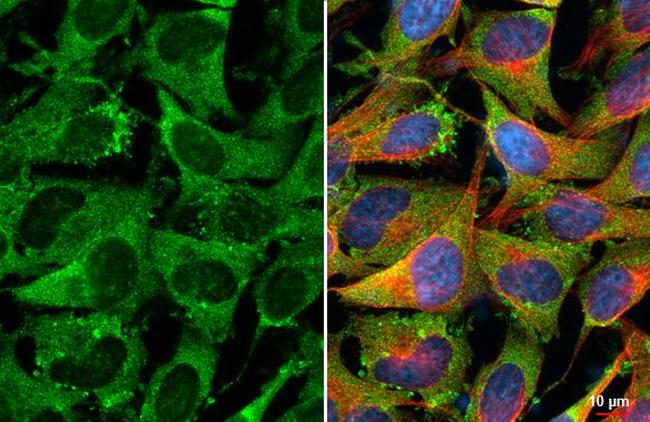 Fibronectin Antibody in Immunocytochemistry (ICC/IF)
