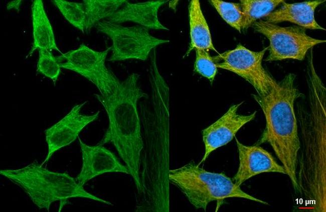 FLII Antibody in Immunocytochemistry (ICC/IF)
