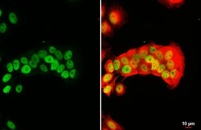 FOXA1 Antibody in Immunocytochemistry (ICC/IF)