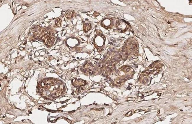 Phospho-FOXO1 (Ser256) Antibody in Immunohistochemistry (Paraffin) (IHC (P))