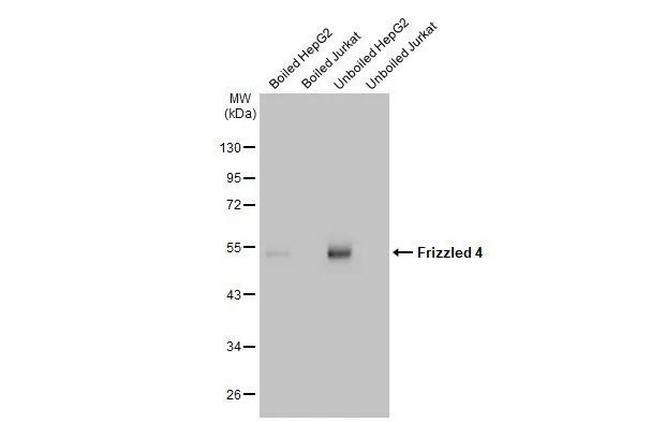 FZD4 Antibody in Western Blot (WB)