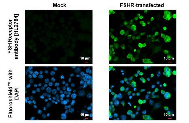 FSHR Antibody in Immunocytochemistry (ICC/IF)