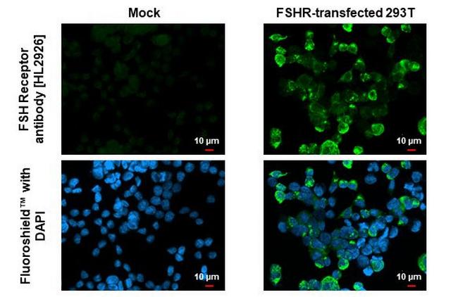 FSHR Antibody in Immunocytochemistry (ICC/IF)