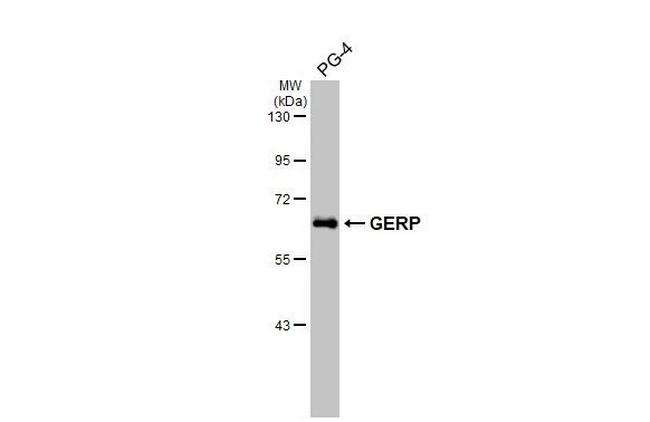 TRIM8 Antibody in Western Blot (WB)