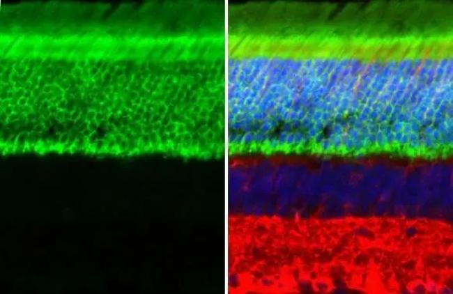 GNAT1 Antibody in Immunohistochemistry (Paraffin) (IHC (P))
