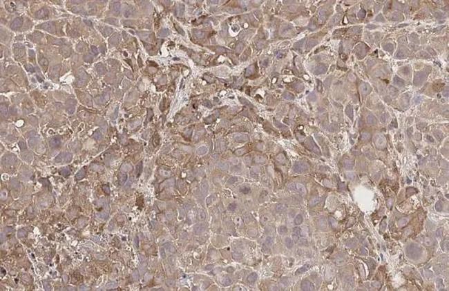 GnRHR Antibody in Immunohistochemistry (Paraffin) (IHC (P))
