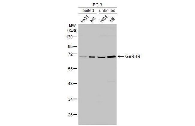 GnRHR Antibody in Western Blot (WB)