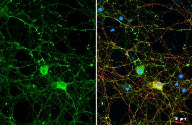 GPM6A Antibody in Immunocytochemistry (ICC/IF)