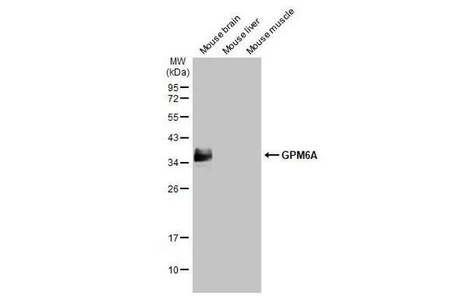 GPM6A Antibody in Western Blot (WB)