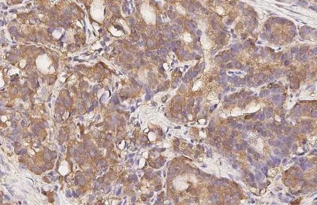GPR43 Antibody in Immunohistochemistry (Paraffin) (IHC (P))