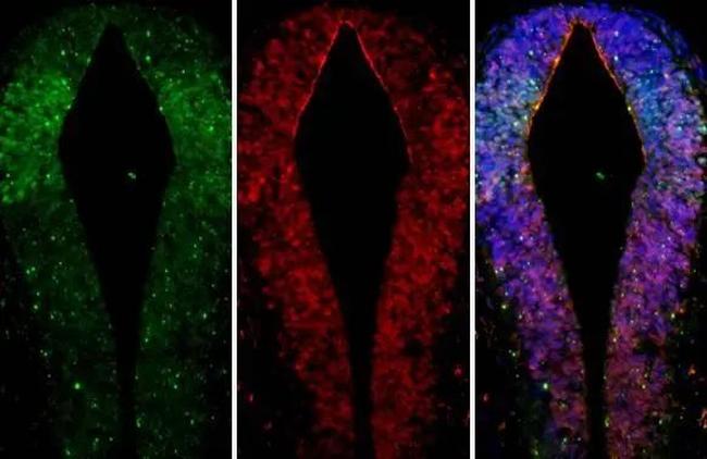 GSX2 Antibody in Immunohistochemistry (Paraffin) (IHC (P))