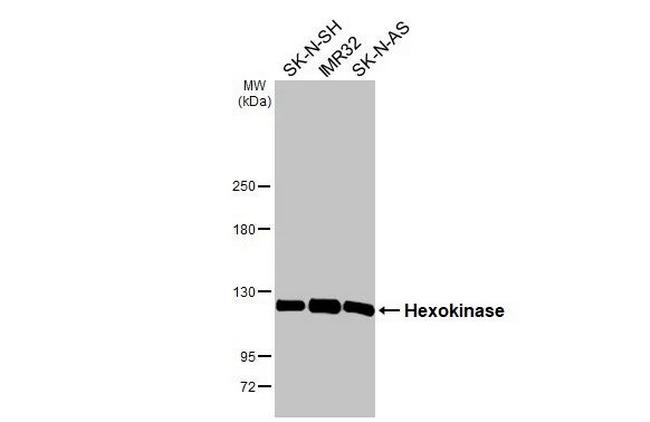 Hexokinase Antibody in Western Blot (WB)
