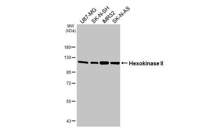 HK2 Antibody in Western Blot (WB)