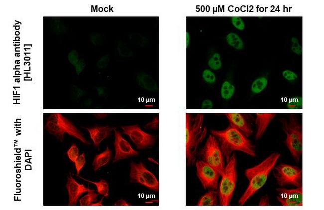 HIF1A Antibody in Immunocytochemistry (ICC/IF)