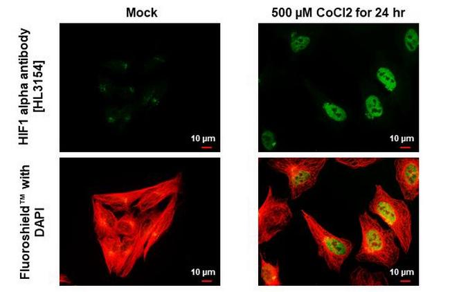 HIF1A Antibody in Immunocytochemistry (ICC/IF)