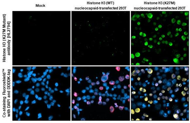 H3K27M Antibody in Immunocytochemistry (ICC/IF)