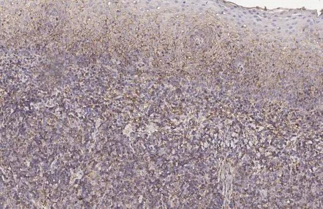 HLA Class I Antibody in Immunohistochemistry (Paraffin) (IHC (P))