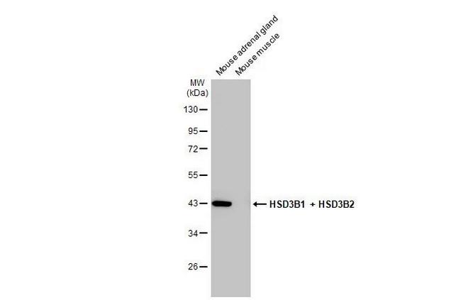 HSD3B1/HSD3B2 Antibody in Western Blot (WB)