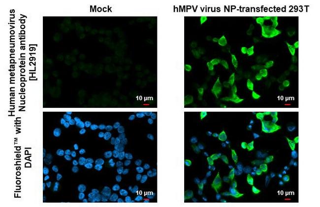 Metapneumovirus Nucleoprotein Antibody in Immunocytochemistry (ICC/IF)