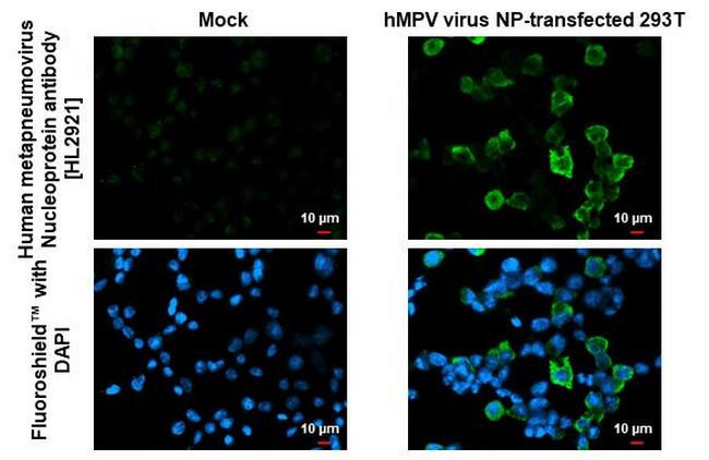 Metapneumovirus Nucleoprotein Antibody in Immunocytochemistry (ICC/IF)