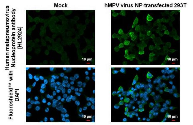Metapneumovirus Nucleoprotein Antibody in Immunocytochemistry (ICC/IF)