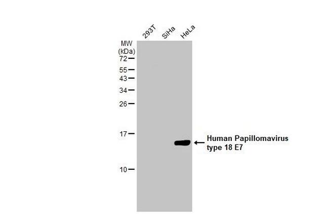 HPV Type 18 E7 Antibody in Western Blot (WB)