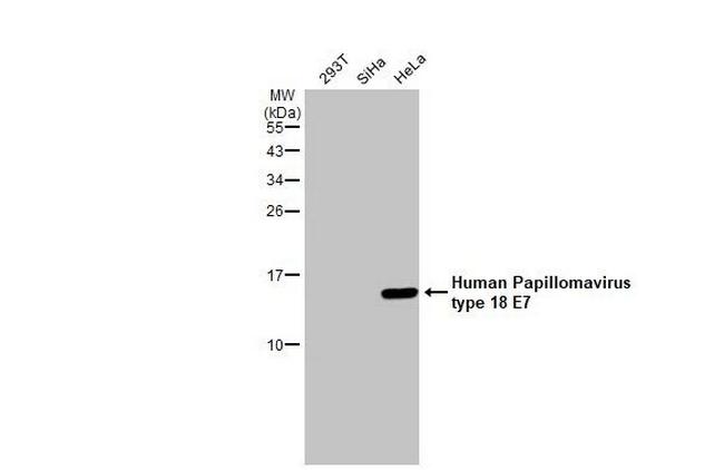 HPV Type 18 E7 Antibody in Western Blot (WB)