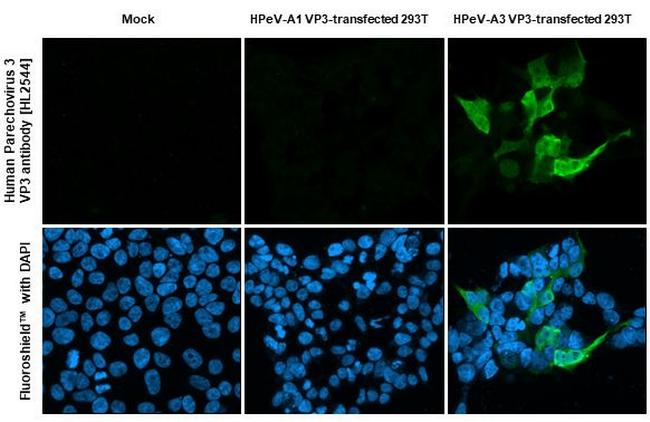 Human Parechovirus 3 VP3 (Strain: WA17c-06) Antibody in Immunocytochemistry (ICC/IF)