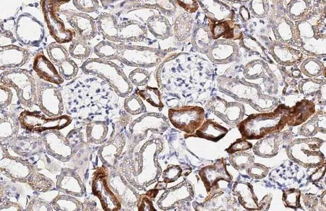 IGF2 Antibody in Immunohistochemistry (Paraffin) (IHC (P))