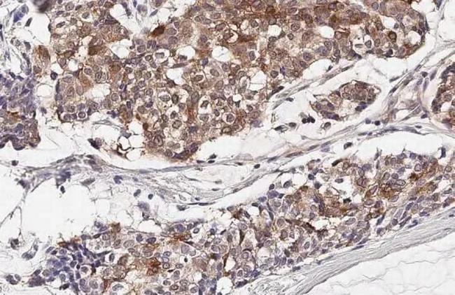 IL-2 Antibody in Immunohistochemistry (Paraffin) (IHC (P))