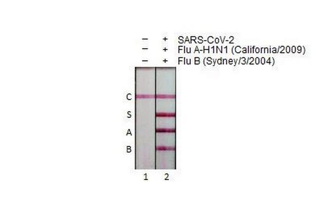 Influenza A virus NP (A/California/2009) Antibody in Lateral Flow (LF)
