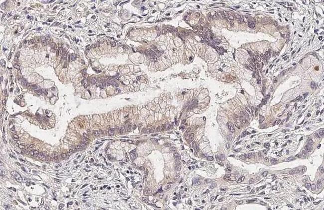 INSR beta Antibody in Immunohistochemistry (Paraffin) (IHC (P))